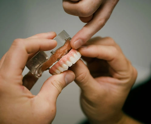 All On X Teeth Image