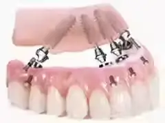 Zirconia-Image