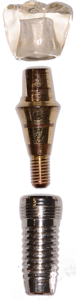 Single Implant image