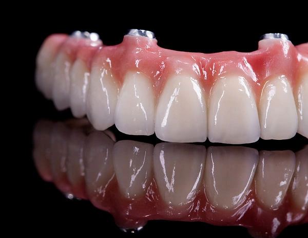 Volume 4 Dental Implants Image