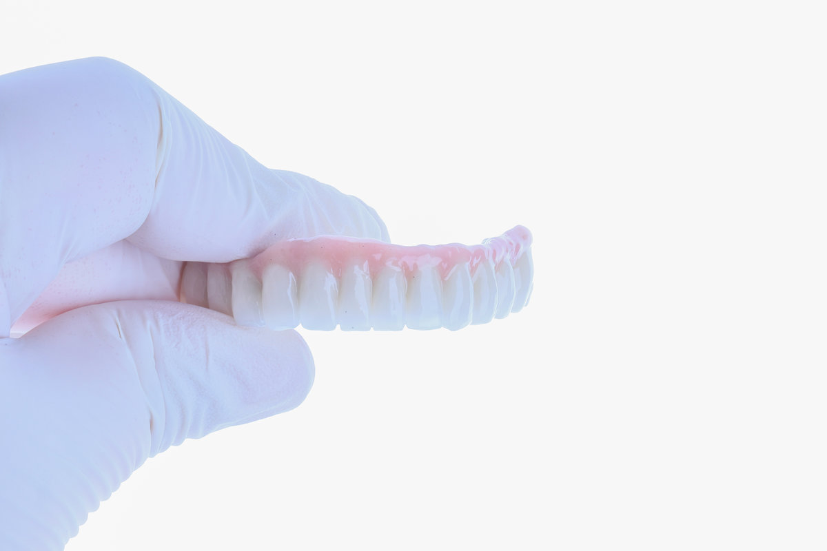 Dental implant supported full arch porcelain dental prosthesis for edentulous jaws in dentistry. Intraosseous dental implant and full arch dental prosthesis treatment. smile makeover.